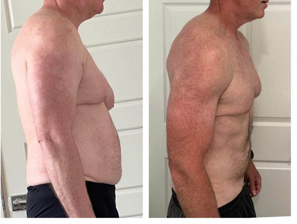 Weight Loss