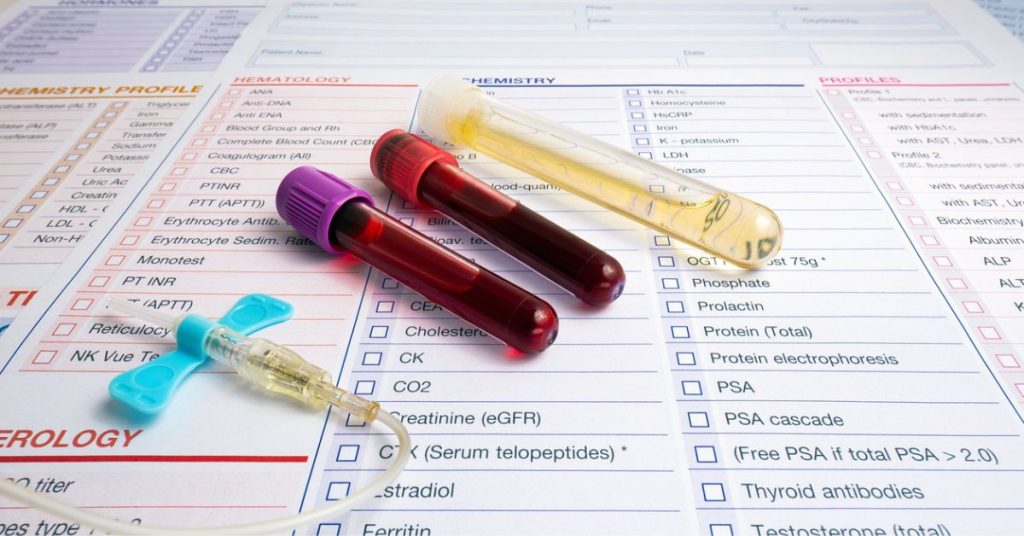 Blood test tubes to represent biological age testing