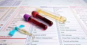 Blood test tubes to represent biological age testing