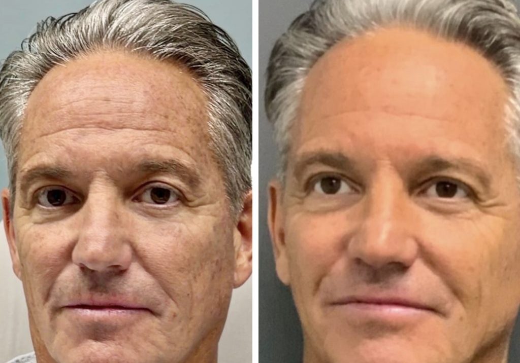 before and after photos