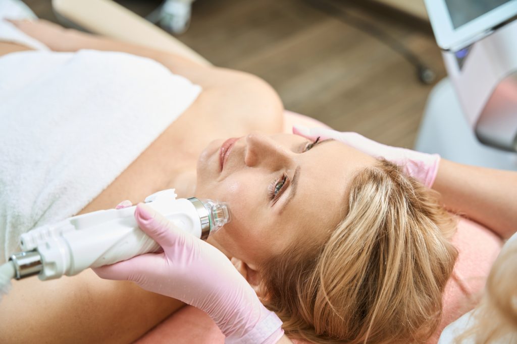 woman having RF microneedling on her face